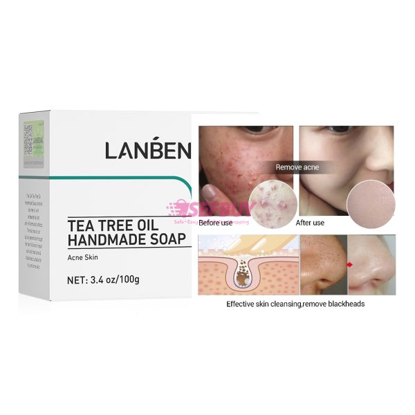 7 Days Pimples & Acne Tea Tree Soap - 100g